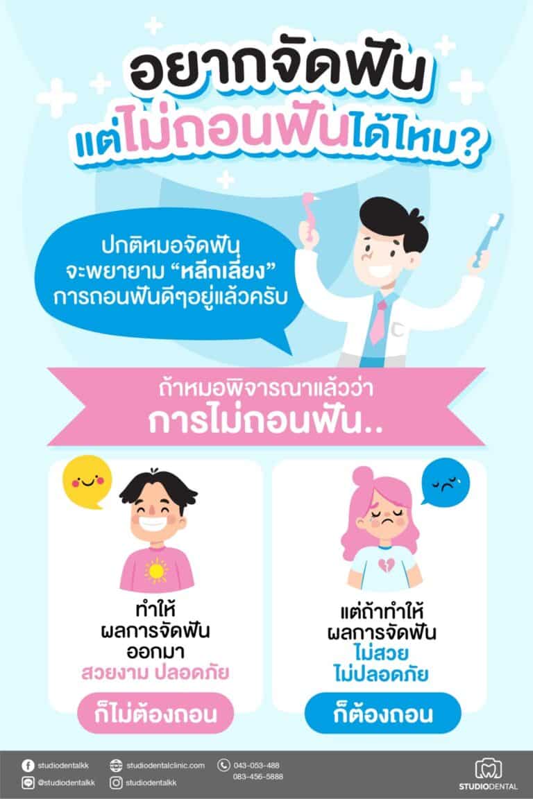 จัดฟันไม่ถอน